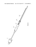 Inter-Body Implantation System and Method diagram and image