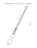 Inter-Body Implantation System and Method diagram and image