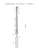 Inter-Body Implantation System and Method diagram and image