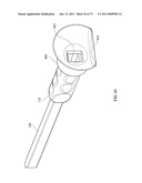 Inter-Body Implantation System and Method diagram and image