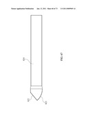 Inter-Body Implantation System and Method diagram and image