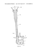 Inter-Body Implantation System and Method diagram and image