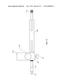 Inter-Body Implantation System and Method diagram and image