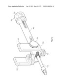 Inter-Body Implantation System and Method diagram and image