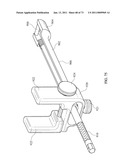 Inter-Body Implantation System and Method diagram and image