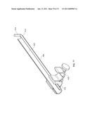 Inter-Body Implantation System and Method diagram and image