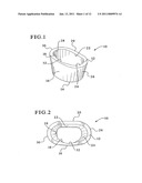 TIBIAL AUGMENTS FOR USE WITH KNEE JOINT PROSTHESES, METHOD OF IMPLANTING THE TIBIAL AUGMENT, AND ASSOCIATED TOOLS diagram and image