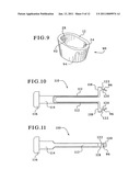 TIBIAL AUGMENTS FOR USE WITH KNEE JOINT PROSTHESES, METHOD OF IMPLANTING THE TIBIAL AUGMENT, AND ASSOCIATED TOOLS diagram and image