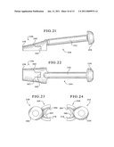 TIBIAL AUGMENTS FOR USE WITH KNEE JOINT PROSTHESES, METHOD OF IMPLANTING THE TIBIAL AUGMENT, AND ASSOCIATED TOOLS diagram and image