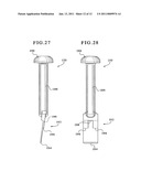 TIBIAL AUGMENTS FOR USE WITH KNEE JOINT PROSTHESES, METHOD OF IMPLANTING THE TIBIAL AUGMENT, AND ASSOCIATED TOOLS diagram and image