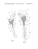 HIP STEM PROSTHESIS diagram and image