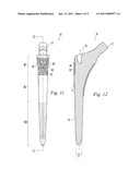 HIP STEM PROSTHESIS diagram and image