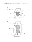 DEVICE COMPRISING A SWELLING AGENT AND SHEATHING FOR ARTIFICIAL CALLUS DISTRACTION diagram and image