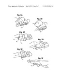 Tubular Wrap And Methods For Its Use diagram and image