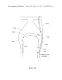 STIRLING CYCLE MACHINE diagram and image