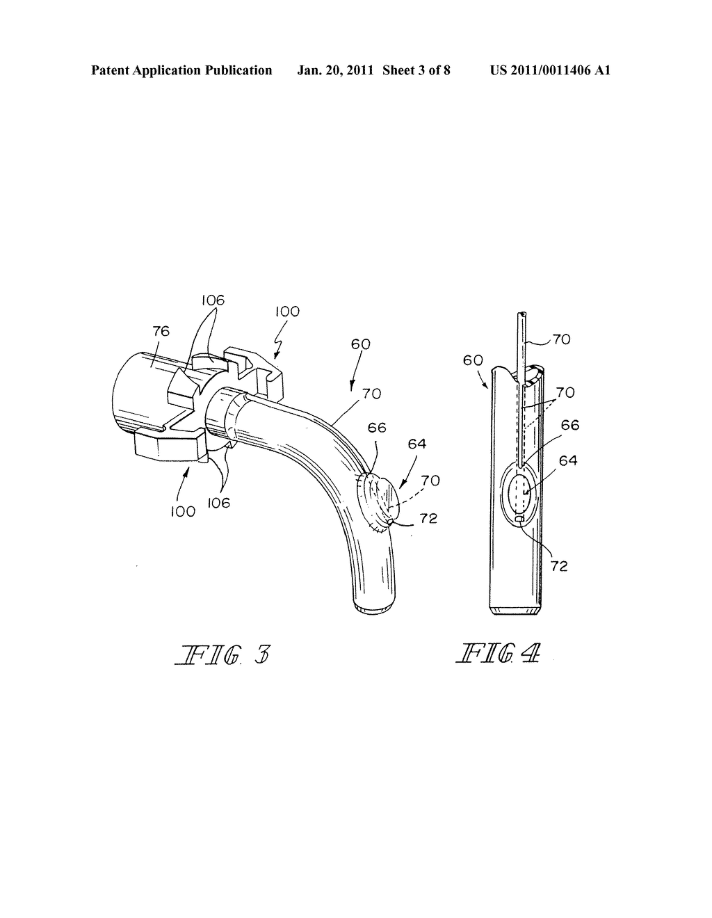 Valved Fenestrated Tracheotomy Tube Having Outer and Inner Cannulae - diagram, schematic, and image 04