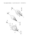 LAUNCH AND RECOVERY SYSTEM FOR UNMANNED AERIAL VEHICLES diagram and image