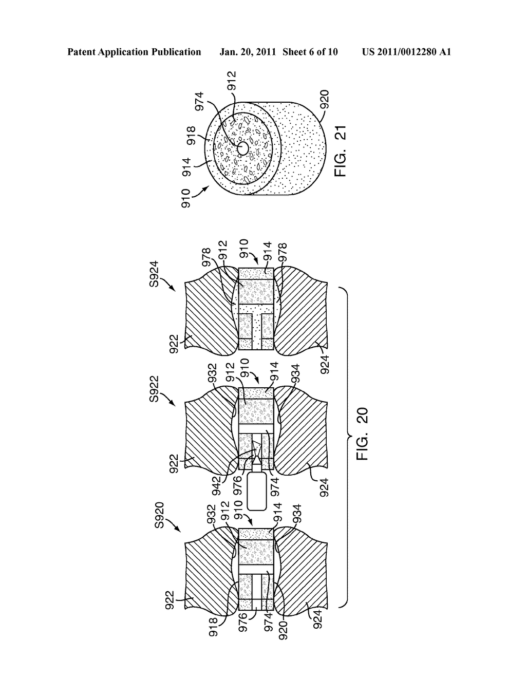 METHOD FOR FABRICATING A MULTI-DENSITY POLYMERIC INTERBODY SPACER - diagram, schematic, and image 07