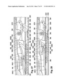 MECHANISM FOR AN ADJUSTABLE BODY COMPONENT OF A VEHICLE diagram and image