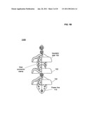 Systems and methods for assessing standoff capabilities of in-service power line insulators diagram and image