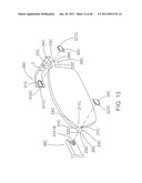 Spectacles diagram and image