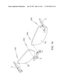 Spectacles diagram and image