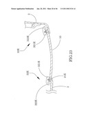 Spectacles diagram and image