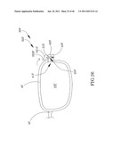 Spectacles diagram and image