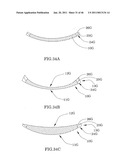 Spectacles diagram and image