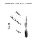 Recombinant Human CLN2 Protein and Methods of Its Production and Use diagram and image