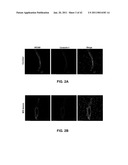 MCAM MODULATION AND USES THEREOF diagram and image