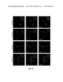 MCAM MODULATION AND USES THEREOF diagram and image