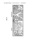 METHODS AND COMPOSITIONS FOR TREATING CHRONIC PELVIC PAIN SYNDROME diagram and image