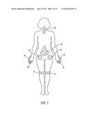 ALPHA ADRENERGIC RECEPTOR AGONISTS FOR PREVENTION OR TREATMENT OF A HEMATOMA, EDEMA, AND/OR DEEP VEIN THROMBOSIS diagram and image