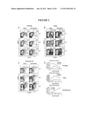  METHOD OF PROPHYLAXIS AND AGENTS FOR USE THEREIN diagram and image