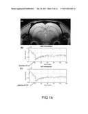 Drug Delivery Nanodevice, its Preparation Method and Uses Thereof diagram and image