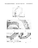 NANOSTRUCTURED MATERIAL LOADED WITH NOBLE METAL PARTICLES diagram and image