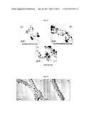 NANOSTRUCTURED MATERIAL LOADED WITH NOBLE METAL PARTICLES diagram and image