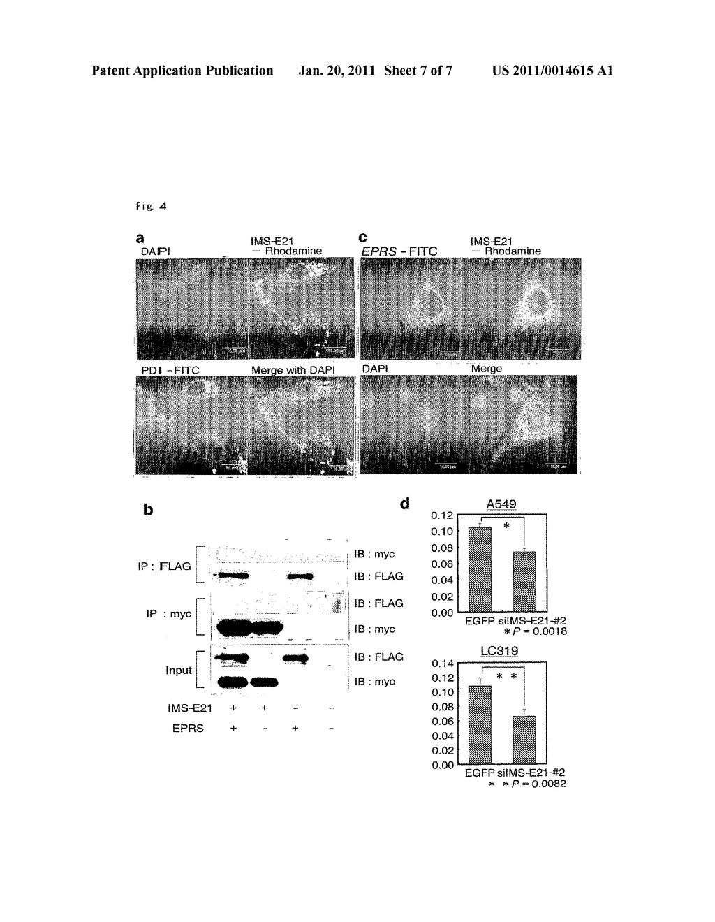 METHOD FOR DIAGNOSING NON-SMALL CELL LUNG CANCERS BY tRNA-DIHYDROURIDINE SYNTHASE ACTIVITY OF URLC8 - diagram, schematic, and image 08