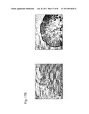 Identification of Surface-Associated Antigens for Tumor Diagnosis and Therapy diagram and image