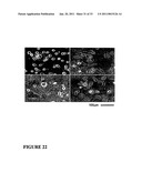 Compositions and Methods For Inducing Apoptosis In Tumor Cells diagram and image