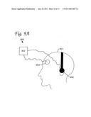 BRAIN STIMULATION SYSTEMS AND METHODS diagram and image