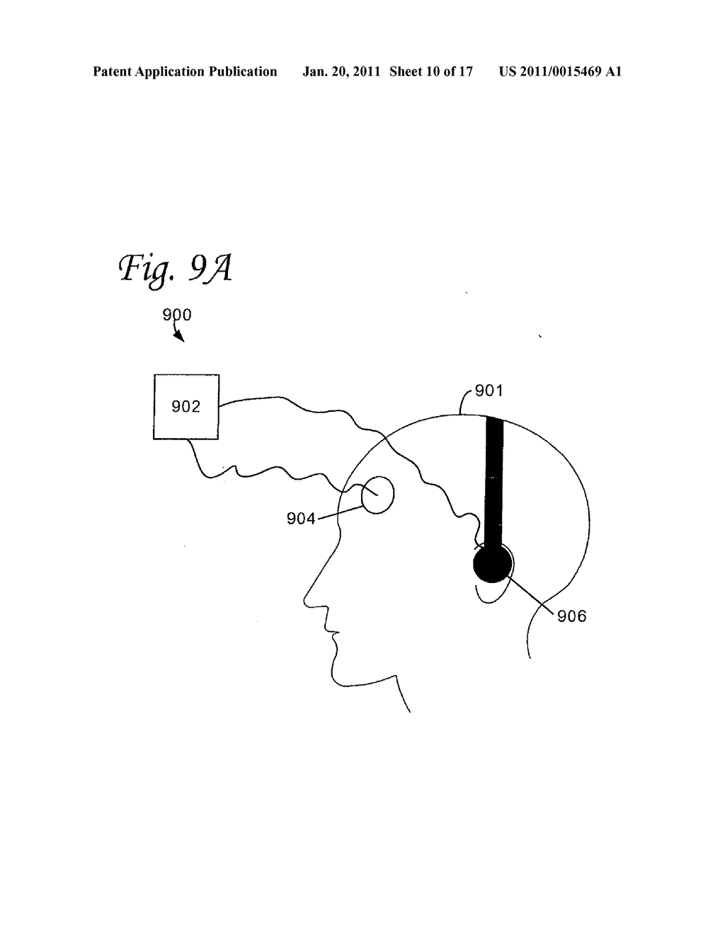 BRAIN STIMULATION SYSTEMS AND METHODS - diagram, schematic, and image 11