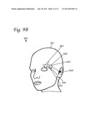 BRAIN STIMULATION SYSTEMS AND METHODS diagram and image