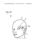 BRAIN STIMULATION SYSTEMS AND METHODS diagram and image