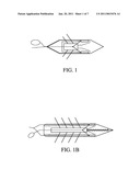 Devices and Methods for Treating Cardiomyopathy diagram and image