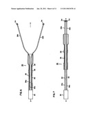 Delivery of cardiac constraint jacket diagram and image