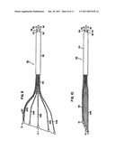 Delivery of cardiac constraint jacket diagram and image