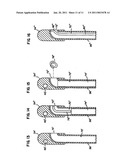 Delivery of cardiac constraint jacket diagram and image