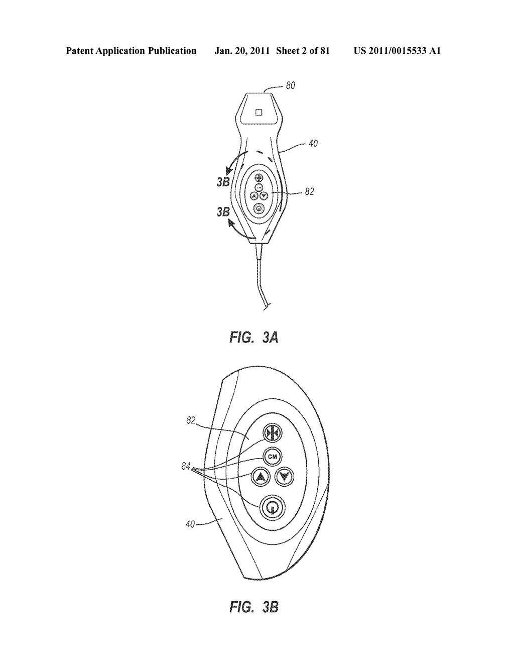 STYLETS FOR USE WITH APPARATUS FOR INTRAVASCULAR PLACEMENT OF A CATHETER - diagram, schematic, and image 03